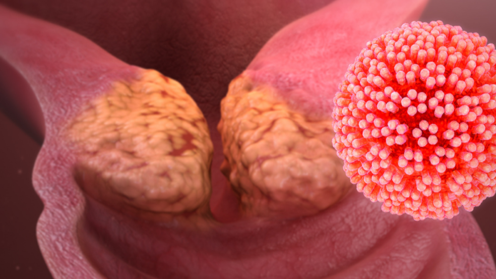 Jornada HPV